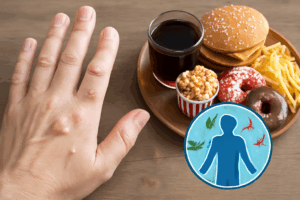 Read more about the article 손발 사마귀 악화시키는 음식, 면역 저하와의 연관성 총정리